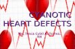 Cyanotic Heart Defects