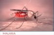 Malaria  . dr surya
