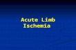 acute limb ischemic