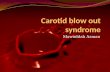 Carotid blow out syndrome