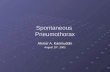 Spontaneous Pneumothorax
