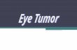 Eye Tumor Full