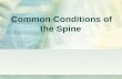 Common Spine Disorders