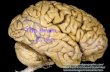 Http://Science.nationalgeographic.co m/Staticfiles/NGS/Shared/StaticFiles/ Science/Images/Content/Humanbrain Vis304784 Ga.jpg
