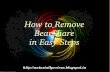 Delete bear share : How to Delete bear share