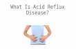 How to treat Acid Reflux and prevent heartburn and chest pain acid reflux symptoms