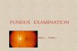Fundus Examination