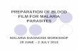 Preparation of blood films for malaria parasites