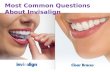 Most Common Questions about Invisalign