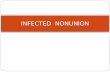 Infected nonunion2
