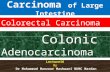 Carcinoma of large intestine, Colorectal Carcinoma (Adenocarcinoma)