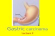 L9 gastric carcinoma f