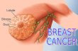 Breast Cancer.ppt