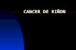 CANCER DE RIÑON. Introducción Representa 2-3 % de todo tipo de cáncer. El tipo más frecuente de lesión solida. 1,5- 1 + frecuente en hombres. Pico de.