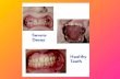 Periodontal/Gum Disease Periodontal/gum diseases are serious infections that, left untreated, can lead to tooth lossPeriodontal/gum diseases are serious.