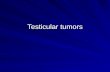 Testicular tumors. Incidence Testicular tumors are rare. 1 – 2 % of all malignant tumors. Most common malignancy in men in the 15 to 35 year age group.