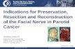 Facial Nerve Repair / Parotid Cancer © Orlando Guntinas-Lichius 2008 Indications for Preservation, Resection and Reconstruction of the Facial Nerve in.