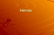 Hernia. Definition : Definition : A hernia is a protrusion of a viscus or a part of viscus through an abnormal opening in the walls of its containing.