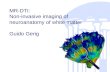 MR-DTI: Non-invasive imaging of neuroanatomy of white matter Guido Gerig.