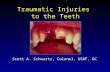 Traumatic Injuries to the Teeth Scott A. Schwartz, Colonel, USAF, DC.