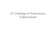 CT Findings in Pulmonary Tuberculosis. Primary Tuberculosis CT helps confirm the presence of an ill-defined parenchymal infiltrate, as well as lymphadenopathy.