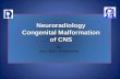 By: Nour-Eldin Mohammed Neuroradiology Congenital Malformation of CNS.