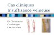 Cas cliniques Insuffisance veineuse Dr Christiaens Cardiologie CHU Poitiers.