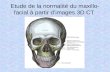 Etude de la normalité du maxillo- facial à partir dimages 3D CT.