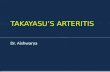 Takayasu arteritis