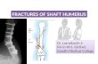 fracture shaft of Humerus
