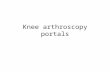 Knee arthroscopy portals