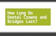 How Long Do Dental Crowns and Bridges Last?