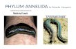 Phylum annelida- excretion in annelida