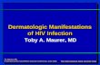 Dermatologic Manifestations of HIV Infection by Toby A ...