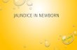 Jaundice in newborn