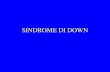 Sindrome di down m
