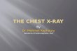 The Normal Chest X-ray