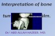 Presentation1.pptx, interpretation of x ray on bone tumour.