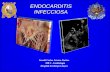 Endocarditis Infecciosa Mr3 Gerald