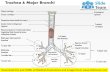 Trachea and major bronchi anterior view medical images for power point