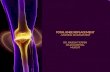 Total knee replacement nursing management