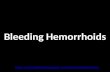 Bleeding hemorrhoids