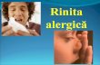 Pneumologie - Rinita alergica