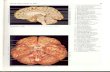 Rochen J.W. Yokochi C. - Anatomia człowieka. Atlas fotograficzny 03 - Głowa