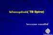 วัณโรคกระดูกสันหลัง (TB Spine)