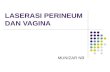 Laserasi Perineum Dan Vagina