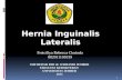 lapsus Hernia Inguinalis lateralis