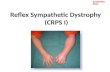 Reflex Sympathetic Dystrophy (CRPS 1)
