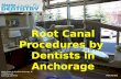 "Root Canal Procedures by  Dentists in Anchorage"