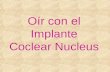 Oir con-el-implante-coclear-nucleus21